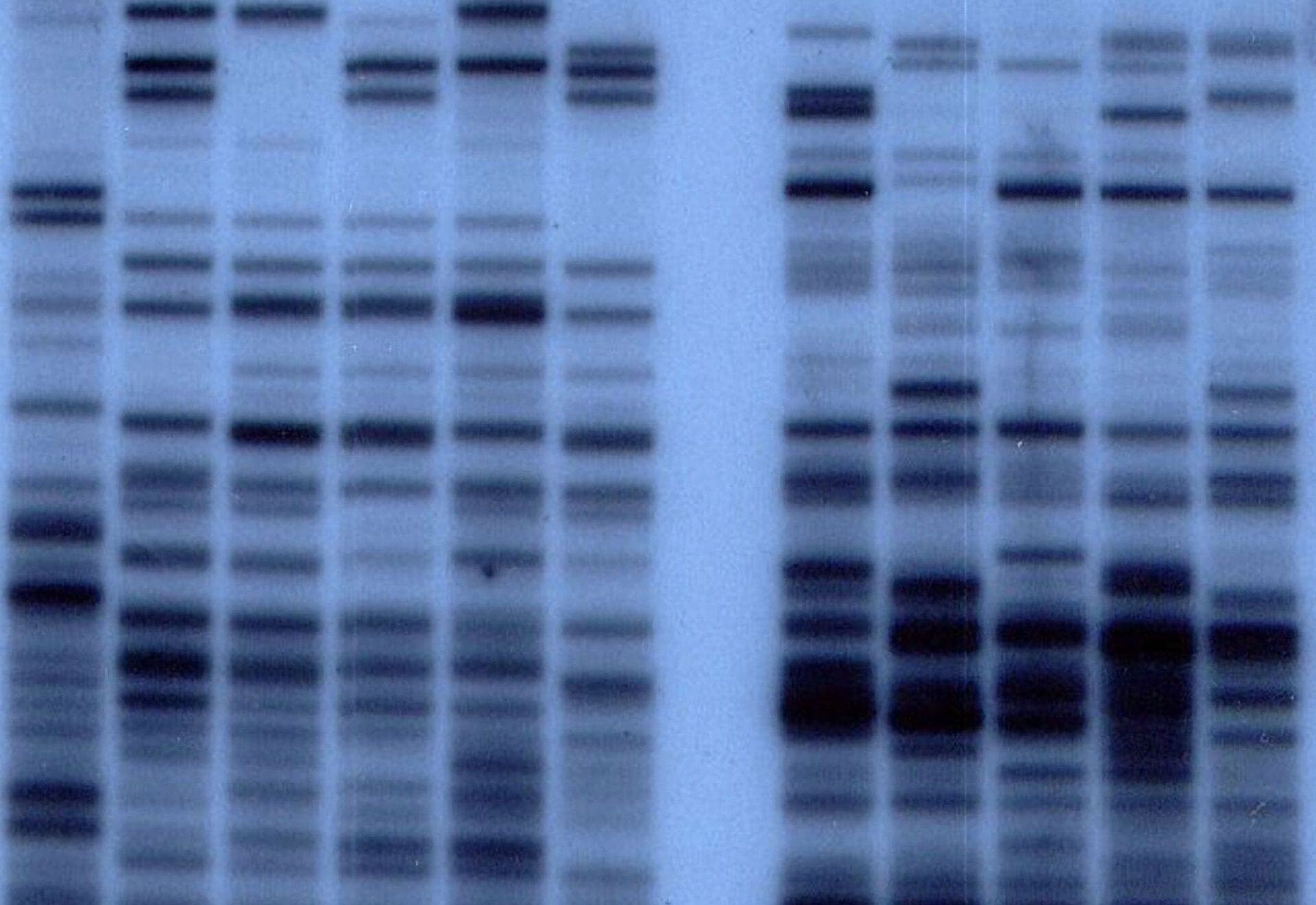 Dna Profiling Questions IB Biology Topic D1.1.5 Applications of Polymerase… | RevisionDojo